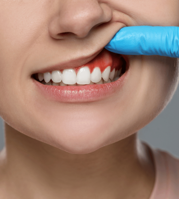 Treatment - Kent Emergency Dentist