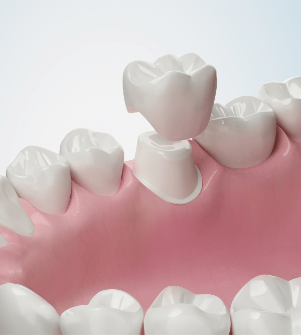 Treatment - Kent Emergency Dentist